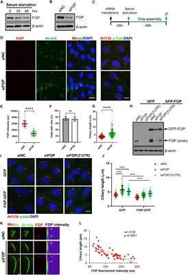 FOP Negatively Regulates Ciliogenesis and Promotes Cell Cycle Re-entry by Facilitating Primary Cilia Disassembly